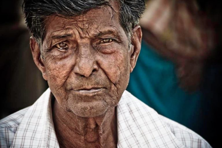 Leprosy: What It Is, What It’s Not, and How You Can Help - Embrace A