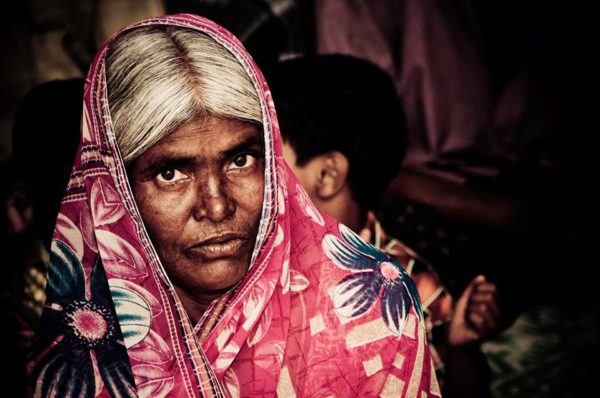 Leprosy: What It Is, What It’s Not, and How You Can Help - Embrace A ...